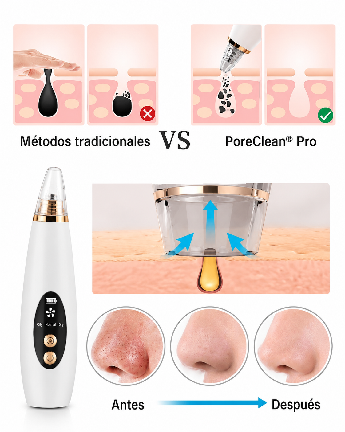 ✨ PoreClean® Pro — Adiós puntos negros y espinillas visibles en minutos